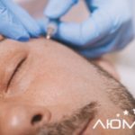 Видалення папілом: який метод видалення обрати?