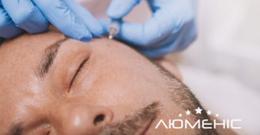 Видалення папілом: який метод видалення обрати?