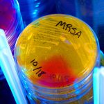 Що означає MRSA: метицилін-резистентний золотистий стафілокок