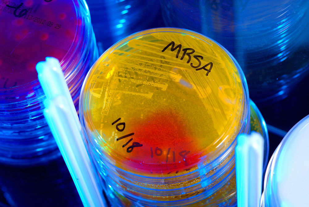 Що означає MRSA: метицилін-резистентний золотистий стафілокок